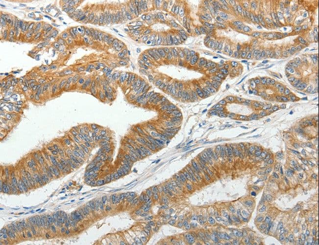 SLC12A4 / KCC1 Antibody