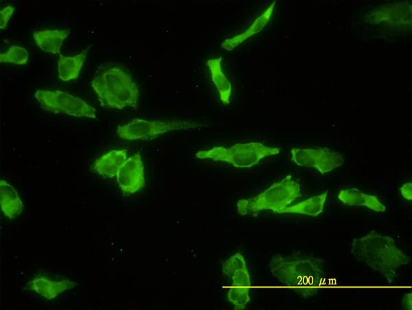 IHC-plus™ ACP2 / Acid Phosphatase 2 Antibody (clone M1-4A12)