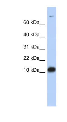 PathPlus™ FABP3 / H-FABP Antibody (aa72-121)