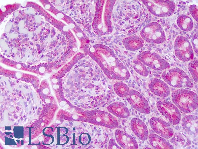 NT5E / eNT / CD73 Antibody (aa433-482, FITC)