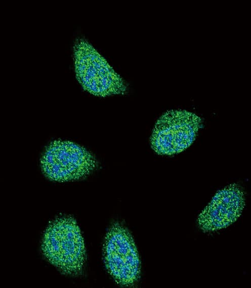 IHC-plus™ SERPINA6 / CBG Antibody (aa197-225)