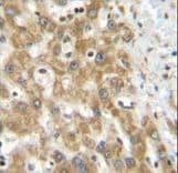 Polyclonal Rabbit anti-Human NIPSNAP3A Antibody (aa74-102, IHC, WB)