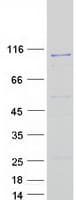 Human HERC6 Protein (Recombinant Myc-DDK (Flag))