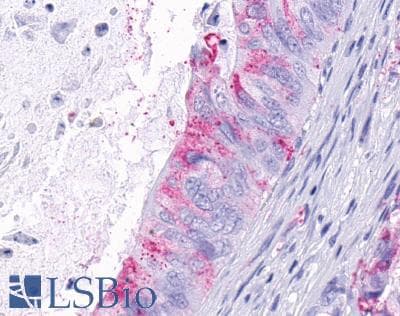 PathPlus™ ADGRA2 / GPR124 Antibody (N-Terminus)