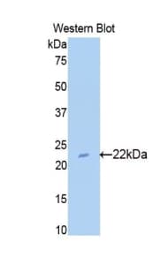 SUOX / Sulfite Oxidase Antibody (aa89-270, Biotin)