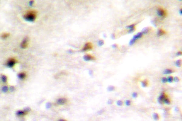 ZFP36L1 Antibody (Asp88)
