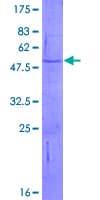 Human ADAMTS12 Protein (Recombinant GST)