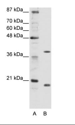 ZNF322 Antibody (C-Terminus)