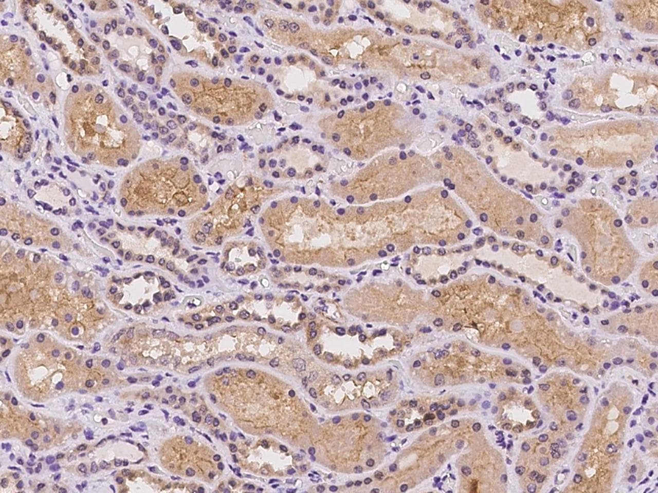 Polyclonal Rabbit anti-Human GRM2 / MGLUR2 Antibody (IHC)