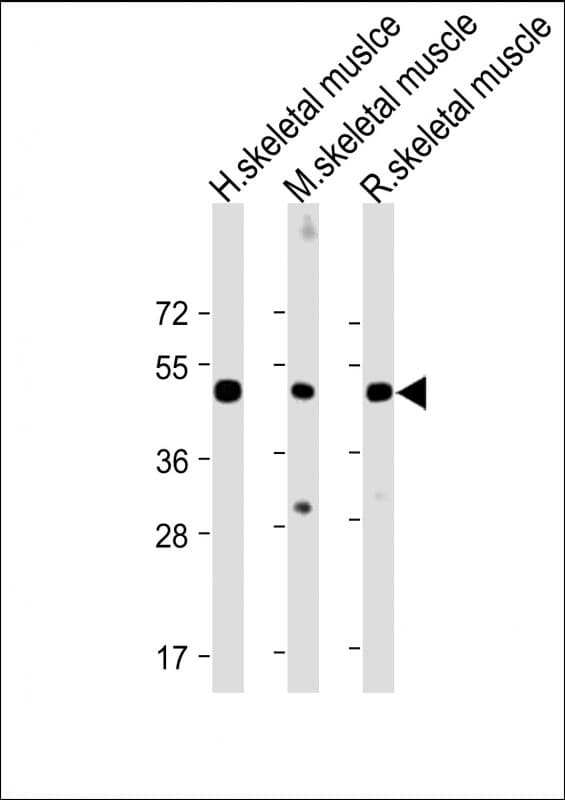 CHRNE Antibody (Internal)