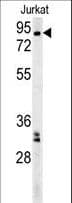 Polyclonal Rabbit anti-Human GGNBP2 / ZNF403 Antibody (aa647-676, IHC, WB)