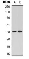 GRAP2 / GRID Antibody (Internal)