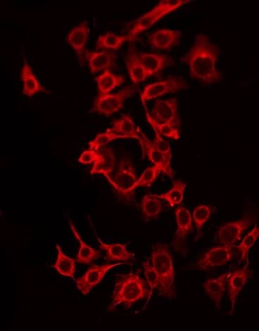 SLC8B1 / SLC24A6 / NCLX Antibody