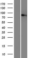 MTMR12 Protein (Over-Expression Lysate Myc-DDK (Flag))