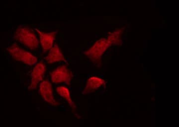 CDKN1B / p27 Kip1 Antibody (phospho-Thr187)