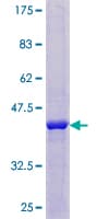 Human NUDT8 Protein (Recombinant GST)