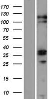 ZC3H12C Protein (Over-Expression Lysate Myc-DDK (Flag))