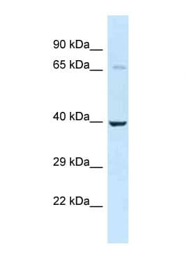 Polyclonal Rabbit anti-Mouse TRAM2 Antibody (C-Terminus, WB)