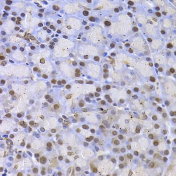 Polyclonal Rabbit anti-Human KAT5 / TIP60 Antibody (IHC, IF, WB)