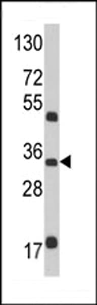 IHC-plus™ M6PR Antibody (aa35-63)