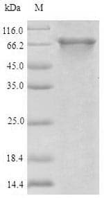 Human ABCB8 Protein (Recombinant 6His-SUMO, N-terminus)