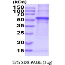 Human ARSA / Arylsulfatase A Protein (Recombinant His)