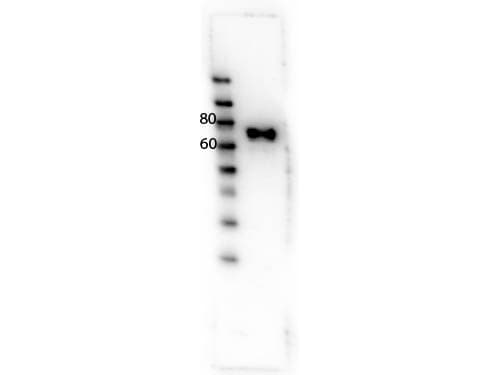 MST1R / RON Antibody