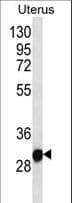 RNF148 Antibody (aa206-234)