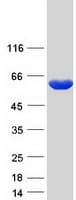 Human HACL1 Protein (Recombinant Myc-DDK (Flag))