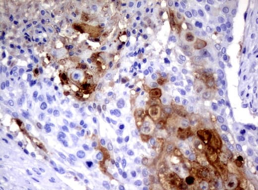 SERPINB4 / SCCA1+2 Antibody (clone UMAB16)