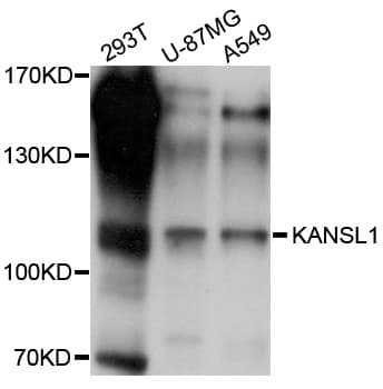 Polyclonal Rabbit anti-Human KIAA1267 Antibody (WB)