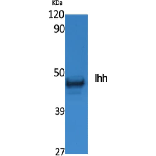 IHH Antibody (Internal)