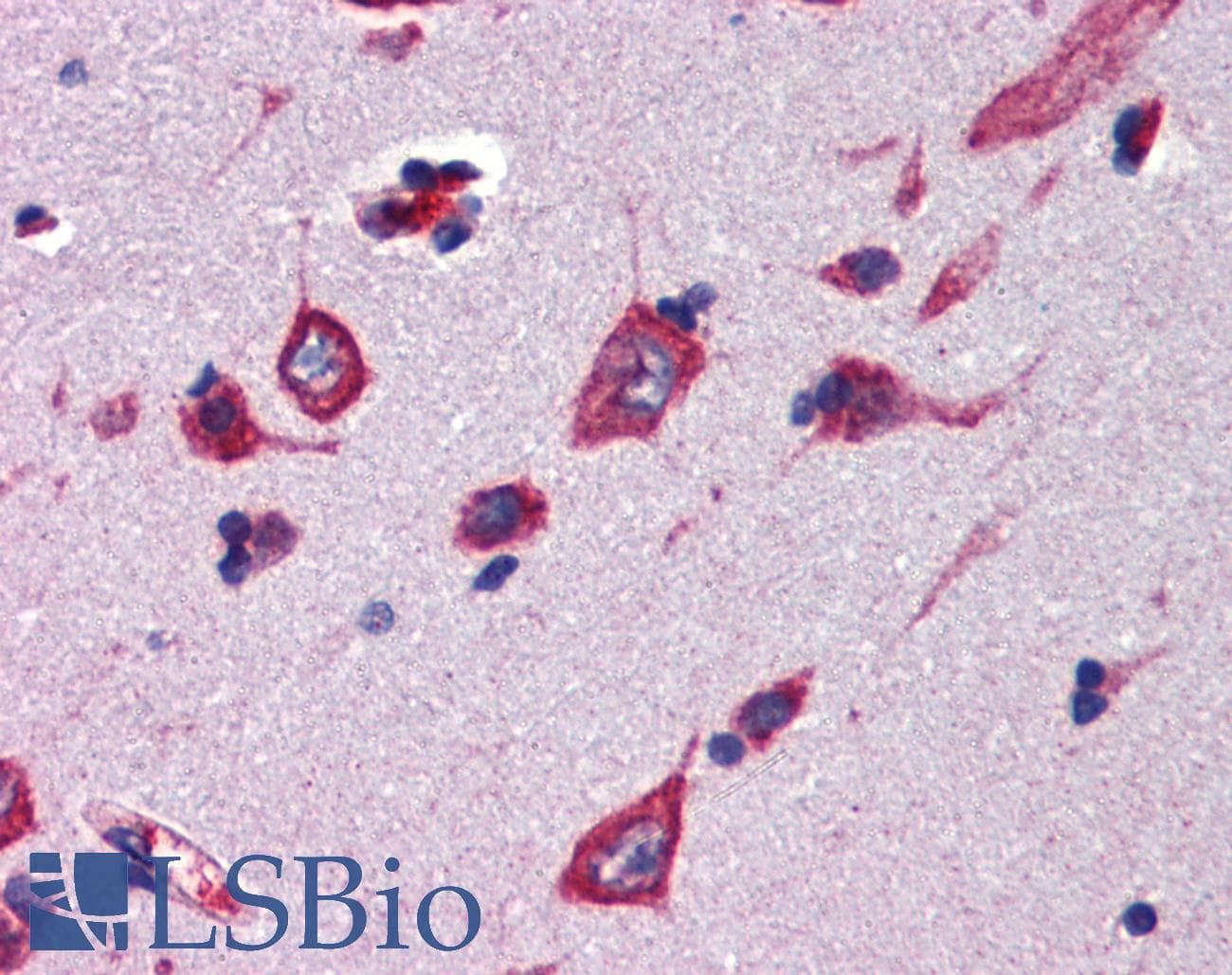 CBLN4 / Cerebellin 4 Antibody (aa125-174)