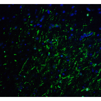 IHC-plus™ LMX1A Antibody