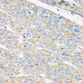 Polyclonal Rabbit anti-Human ARL4A / ARL4 Antibody (IHC, IF)
