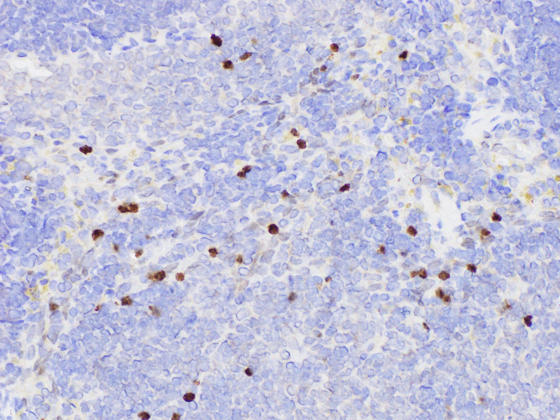 SERPINB2 / PAI-2 Antibody