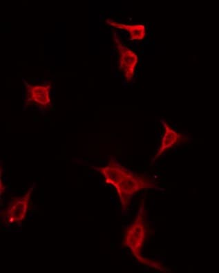 Polyclonal Rabbit anti-Human DUSP19 / SKRP1 Antibody (IF, WB)