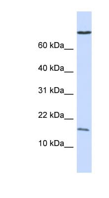 Polyclonal Rabbit anti-Human GABARAP Antibody (N-Terminus, WB)