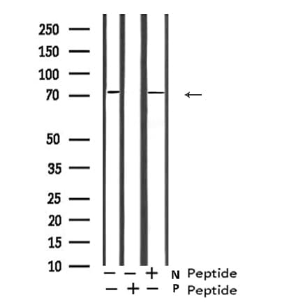 GAB2 Antibody (phospho-Ser623)