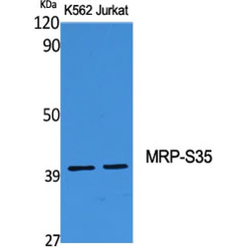 MRPS35 Antibody (180-260 aa, Internal)