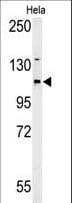 ADCY4 / Adenylate Cyclase 4 Antibody (aa415-441)