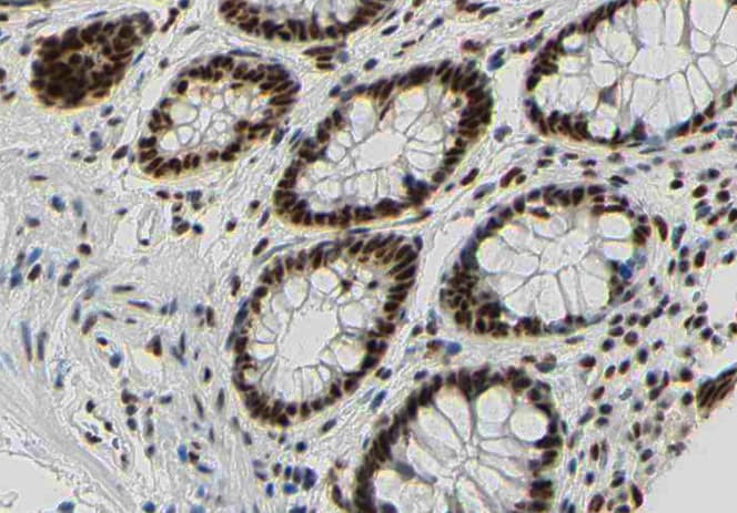 Polyclonal Rabbit anti-Human BCL2 / Bcl-2 Antibody (phospho-Ser87, IHC, IF, WB)