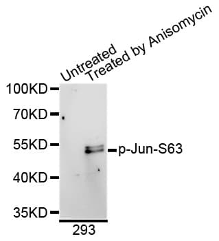 Polyclonal Rabbit anti-Human JUN / c-Jun Antibody (phospho-Ser63, IF, WB)
