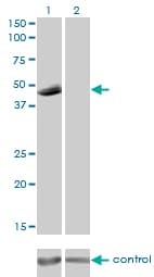 Monoclonal Mouse anti-Human P2RX5 / P2X5 Antibody (clone 1C5, WB)