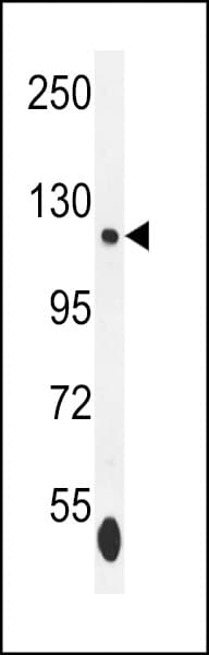 SMARCA5 / SNF2H Antibody (aa946-975)