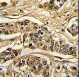 NCS1 / Neuronal Calcium Sensor Antibody (aa118-144)