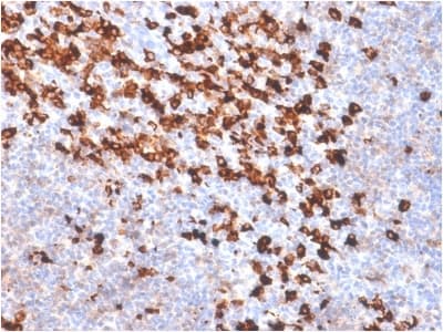 Biotin Antibody (clone BTN/2032R)