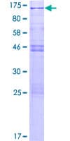 Human CSRP2BP Protein (Recombinant GST)
