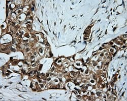 Monoclonal Mouse anti-Human SRR / Serine Racemase Antibody (clone OTI5D10, IHC, WB)