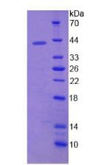Human SCGB1D2 / Lipophilin B Protein (Recombinant His-GST)